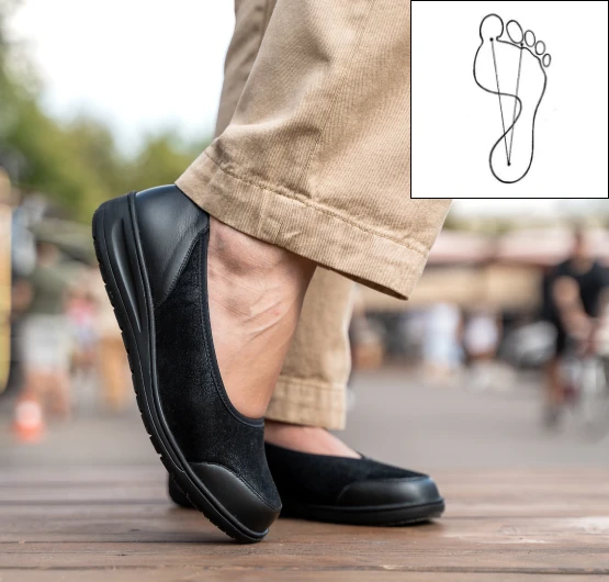 Как подобрать обувь при плоскостопии мужчинам и женщинам